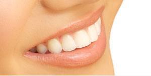 Dentist in Ashburn Virginia Veneers
